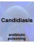 Candidiasis